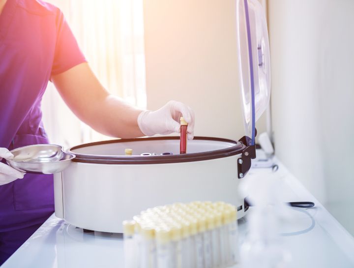 Platelet-Rich Plasma (PRP)